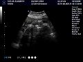 Ultrasound Pics/index.html